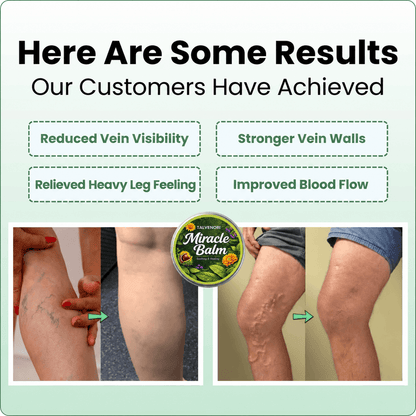 Talvenori™ -  Miracle Balm